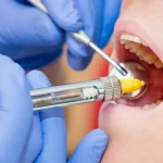 Italie-Algérie : Nouvelles Opportunités sur le Marché des Anesthésiques Dentaires