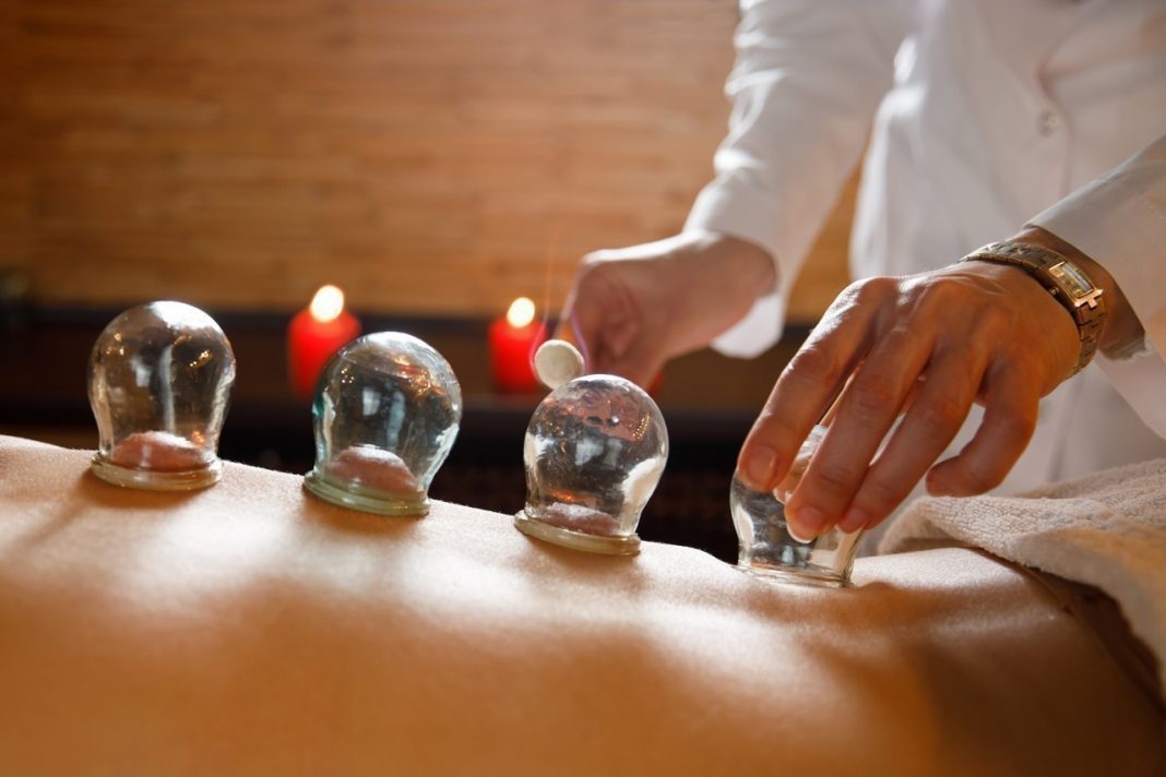 La Hijama en France Pratique Interdite pour Tous, y Compris les Médecins La Hijama en France : Pratique Interdite pour Tous, y Compris les Médecins